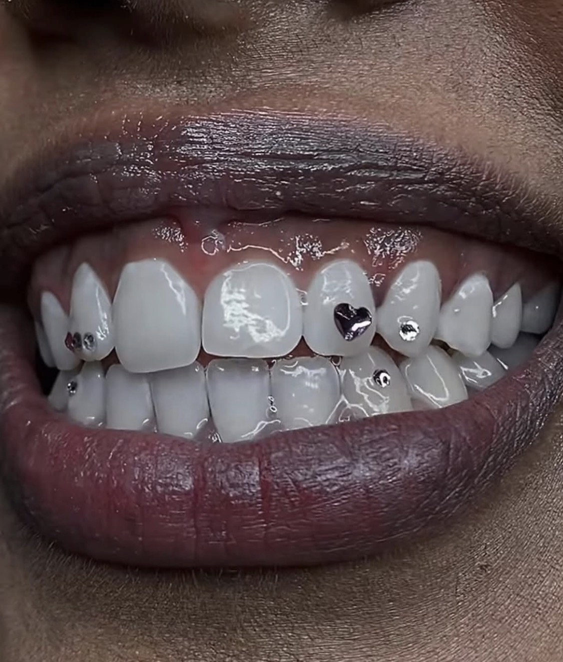 Tooth Gem Station